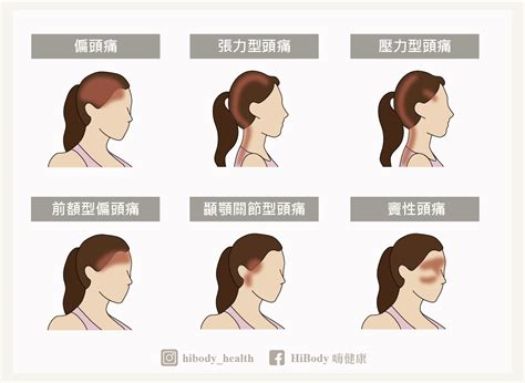 頭有壓迫感|長期焦慮、緊張讓你頭痛？緩解壓力性頭痛這樣做